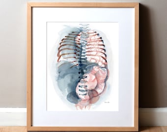 Diaphragmatic Hernia Watercolor Print - Pediatric Art - Hernia Painting