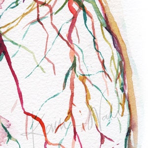 Zoomed in view of a watercolor painting showing a coronary angiogram x-ray image in reds, purples, greens, oranges and yellows.

heart art, heart painting, coronary angiogram, gift for cardiologist