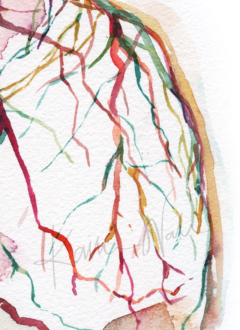 Zoomed in view of a watercolor painting showing a coronary angiogram x-ray image in reds, purples, greens, oranges and yellows.

heart art, heart painting, coronary angiogram, gift for cardiologist