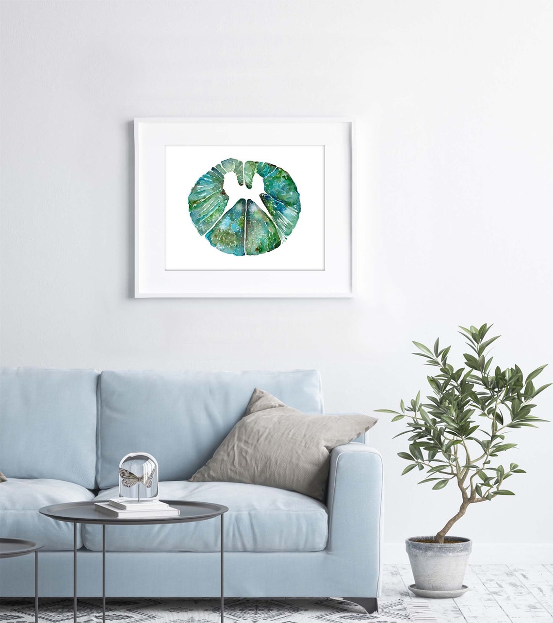 Thoracic Spinal Cord Cross Section Print - Spinal Cord Art Print ...