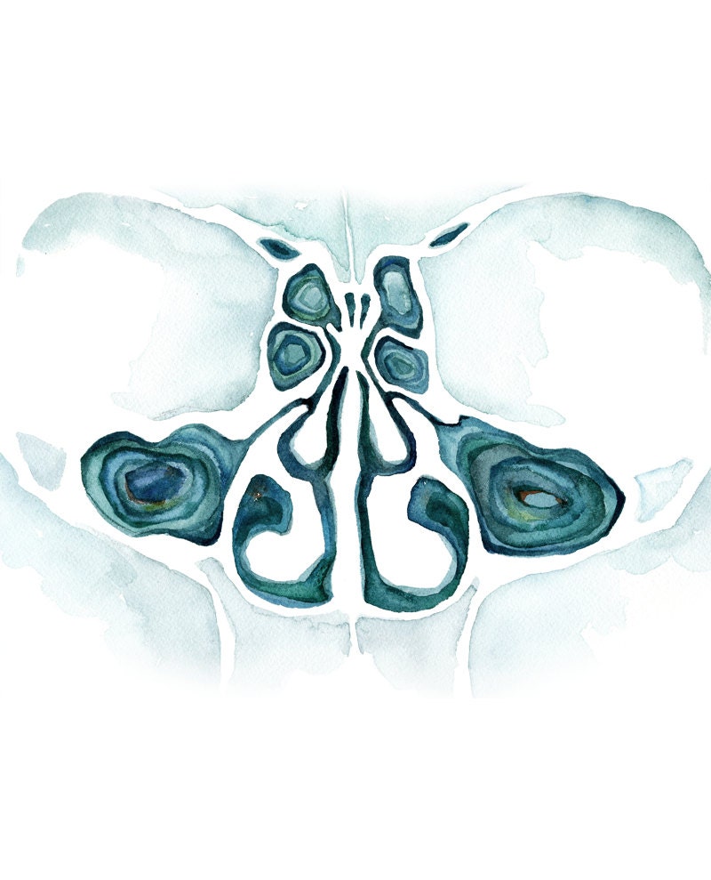 Coronal Section of the Sinuses Watercolor Art Print - ENT and OMFS Art ...