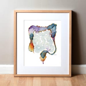 BM Colon Watercolor Print - Colonoscopy Art - Abstract Anatomy Art