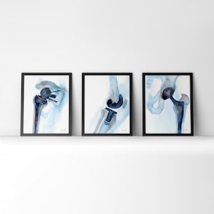 Hip, Shoulder, and Knee Orthopedics Watercolor Print Set - Orthopedic Surgery Art - Gift for PT