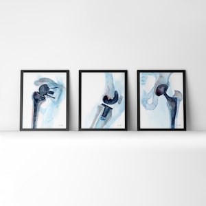 Hip, Shoulder, and Knee Orthopedics Watercolor Print Set Orthopedic Surgery Art Gift for PT image 1