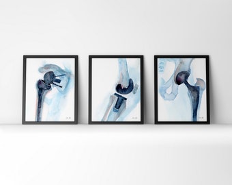 Heup-, schouder- en knie-orthopedie aquarel print set - orthopedische chirurgie kunst - cadeau voor PT