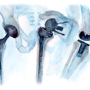 Orthopedics Watercolor Print Orthopedic Surgery Art Medical Art Anatomy Art image 2