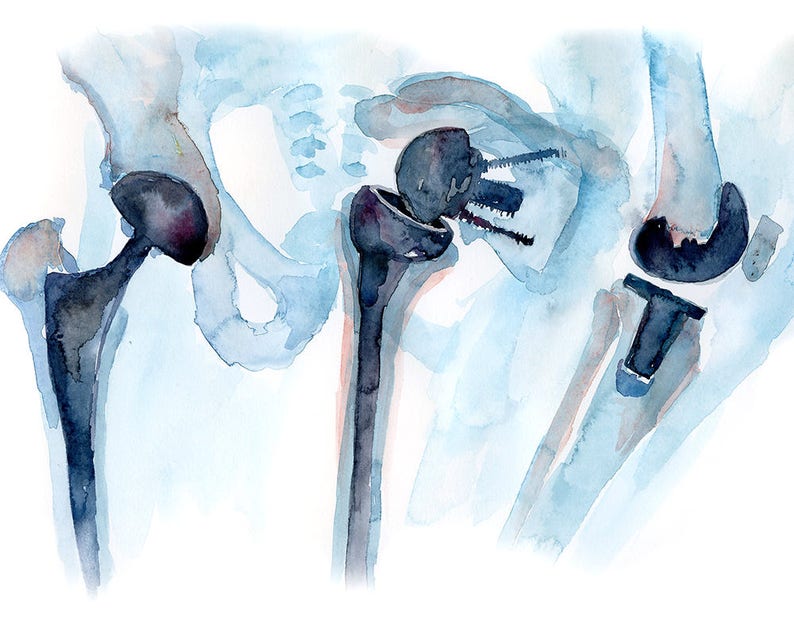 Orthopedics Watercolor Print Orthopedic Surgery Art Medical Art Anatomy Art image 2