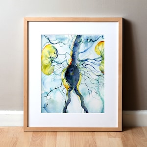 Abdominal Aneurysm Arteriogram Watercolor Print Cardiovascular Painting Blood Vessel Painting Abstract Anatomy Art image 1