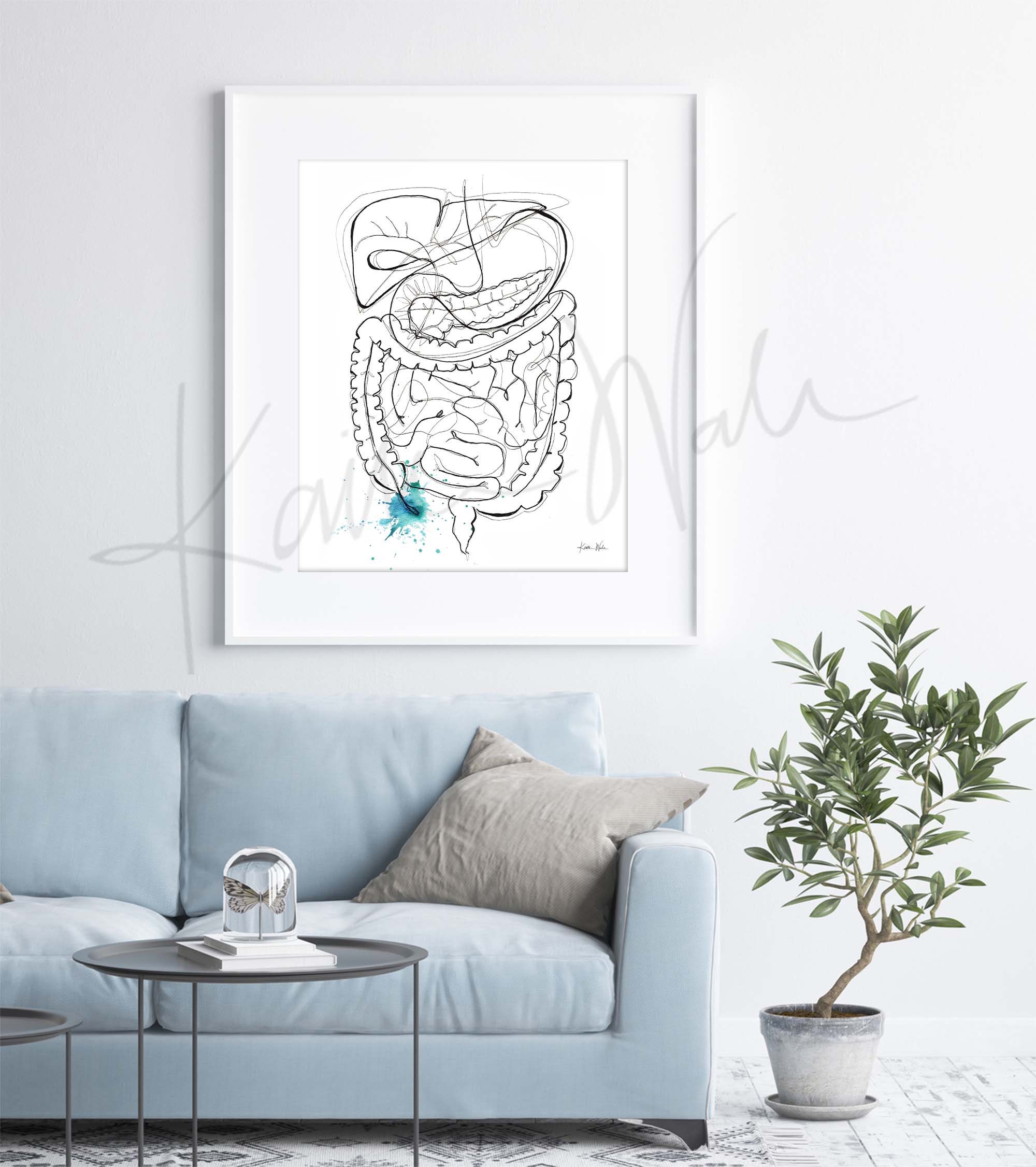 Appendicitis Watercolor Print - GI Anatomy Art - Gastrointestinal ...