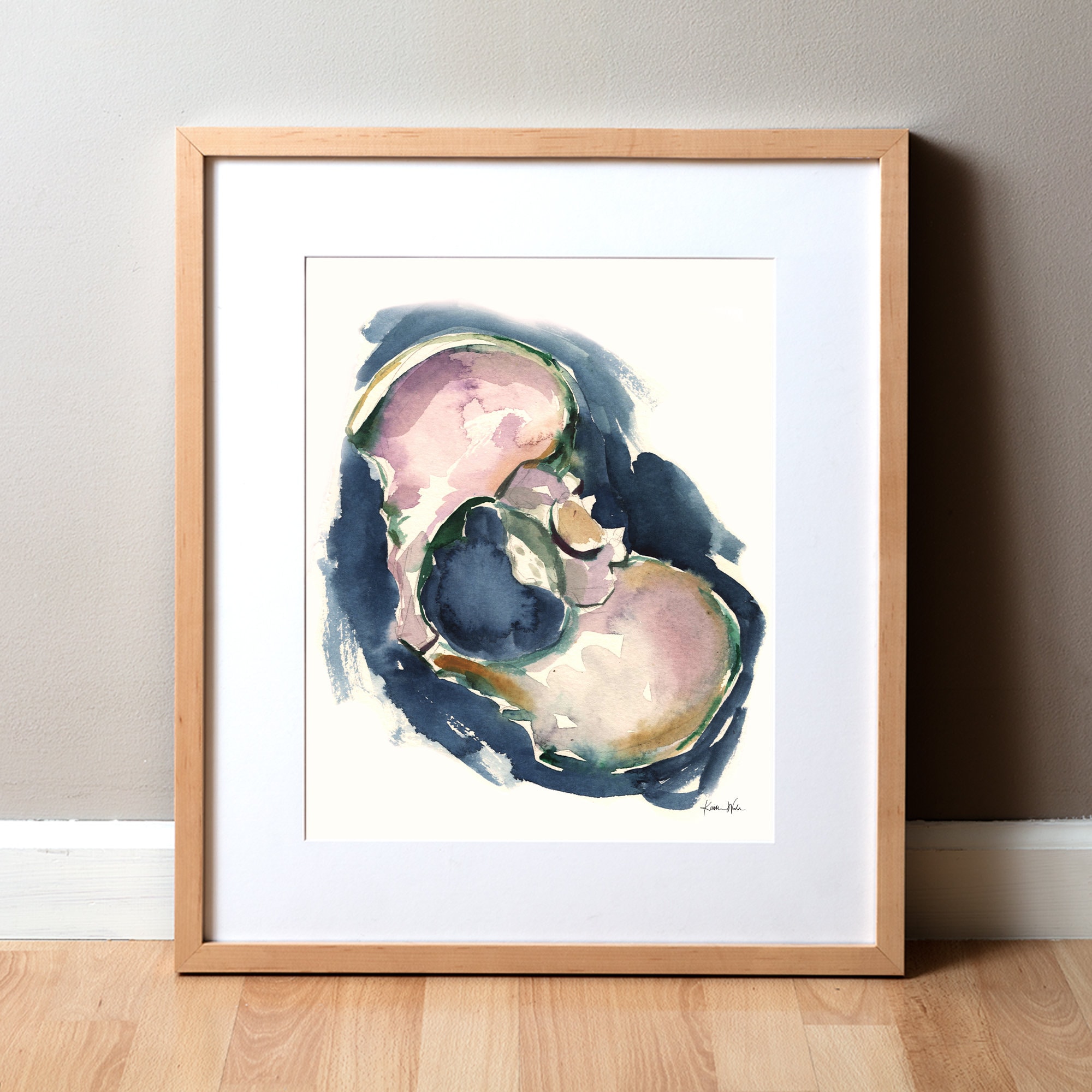 Tilted Pelvis Watercolor Print - Pelvis Art - Orthopedic Print - Medical Art