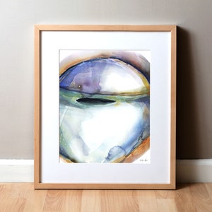 Bulging Cornea Watercolor Print - Keratoconus - Optometry Art