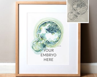 Custom Embryo Watercolor - Commission an Original Painting of Your Embryo