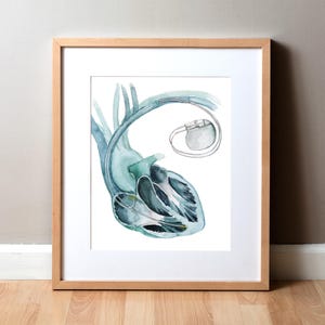 May include: Watercolor print of a human heart with a pacemaker, framed in a light wood frame. The heart is depicted in shades of blue and gray, with the pacemaker in the upper right corner. The artwork is on a white background.