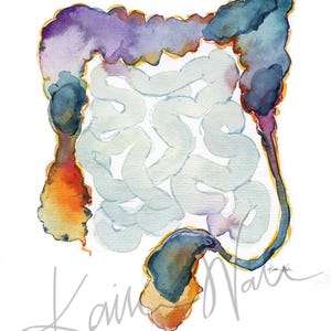 BM Colon Watercolor Print Unframed - Colonoscopy Art - Abstract Anatomy ...