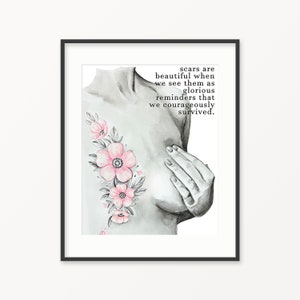 Breast Cancer Awareness Watercolor Print. Scars are Beautiful Art