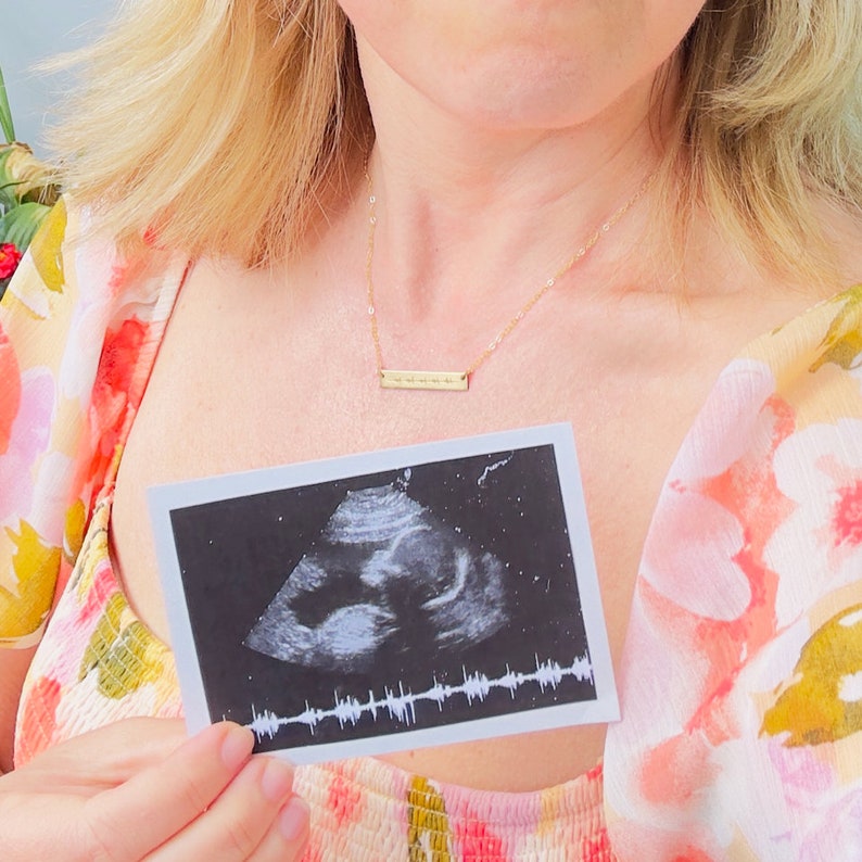 Mother holding ultrasound photo while wearing personalized gold heartbeat bar necklace. Sentimental keepsake jewelry for expecting moms, pregnancy announcement, baby shower gift, or memorial necklace celebrating love and new beginnings.