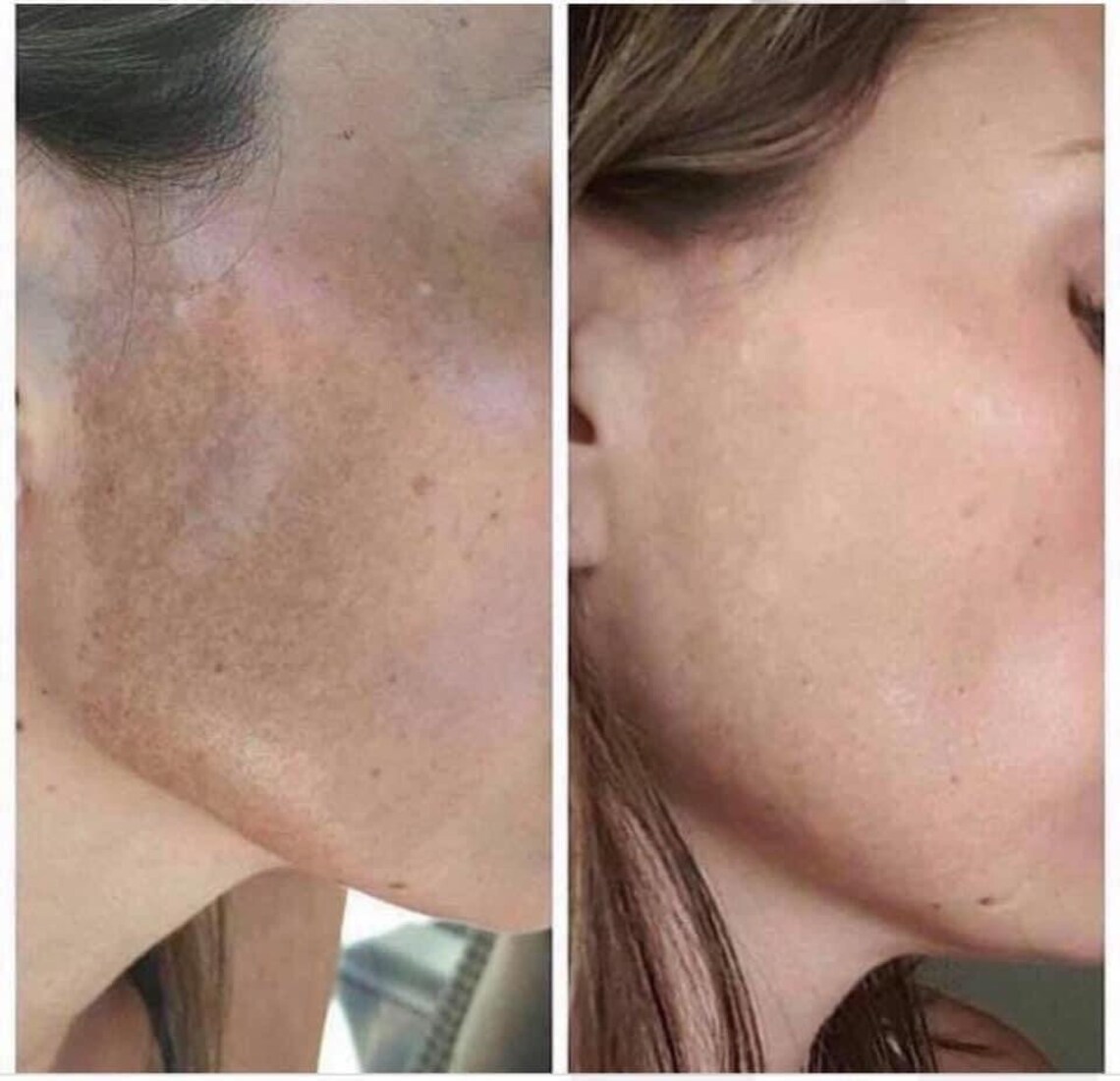 Nu Skin 180 Vitamin C Face Wash for Sun Damage Age Spots and Etsy