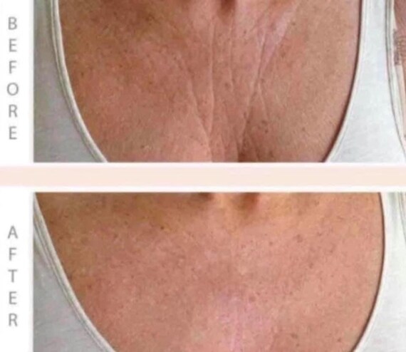 nu skin firming cream