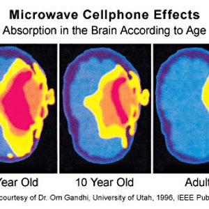 May include: Three brain scans showing the absorption of microwave radiation from cell phones in a 5-year-old, 10-year-old, and adult. The scans show that younger brains absorb more radiation.
