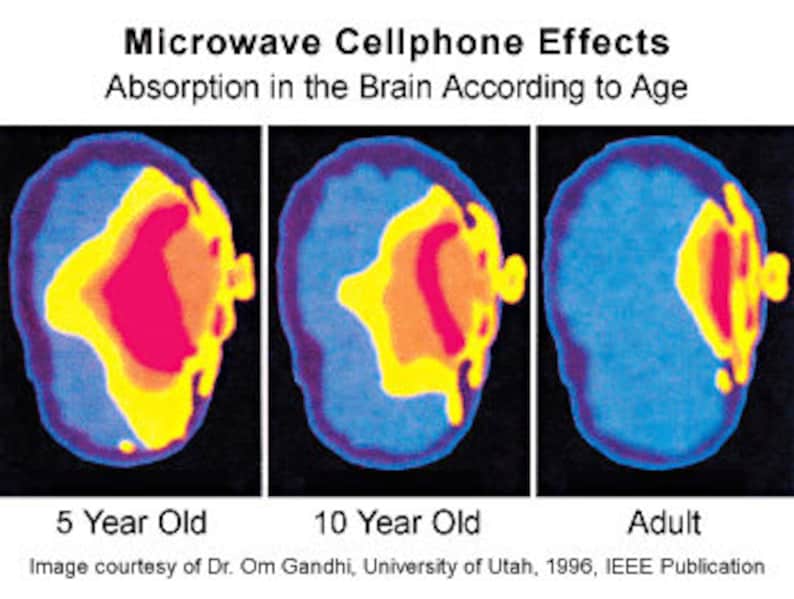 May include: Three brain scans showing the absorption of microwave radiation from cell phones in a 5-year-old, 10-year-old, and adult. The scans show that younger brains absorb more radiation.