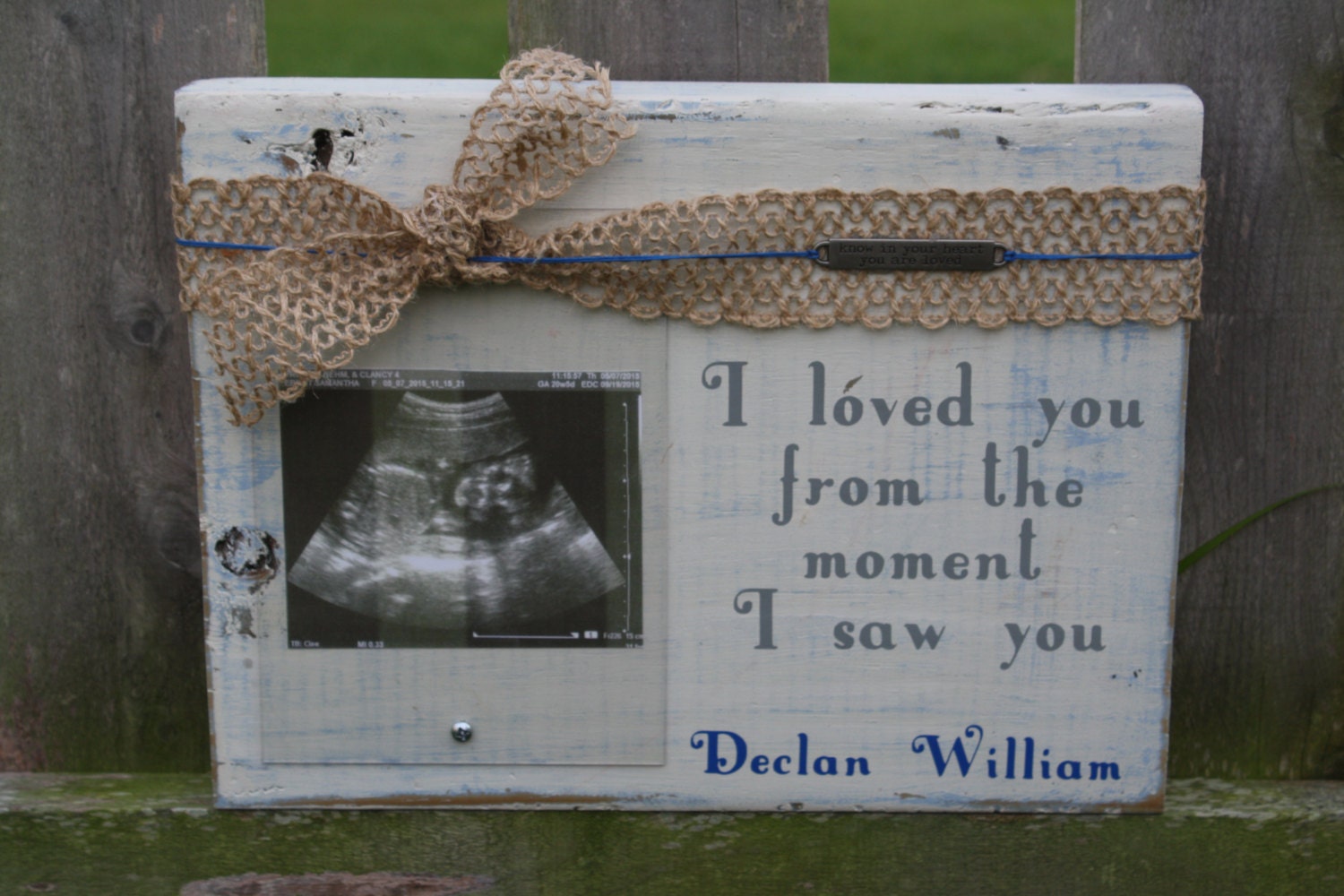 Ultrasound Picture Frame Custom Embellished Wood Block Frame Etsy