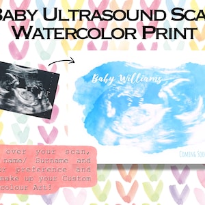 Échographie ou échographie à l'aquarelle, impression de numérisation de bébé, carte, souvenir, numérique disponible, faire-part de révélation de genre, future maman, grossesse