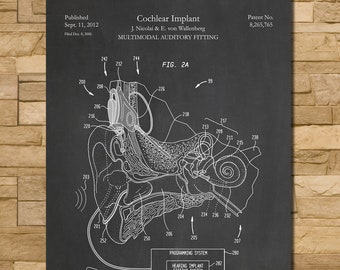 Cochlear Implant Patent Print Art 2012