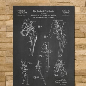 Artificial Hip Patent Print Art 1973