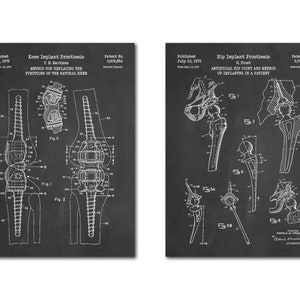 Knee and Hip Implant Patent Art Set of 2
