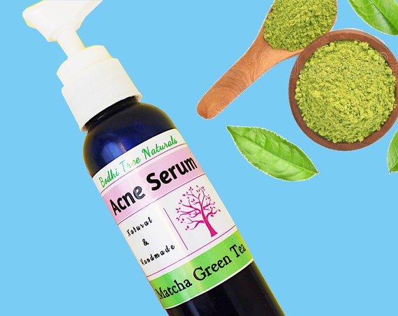 Matcha Exfoliating Acne Serum /Green Tea / Acne Treatment / Problem skin / Oily skin / Handmade skin Care