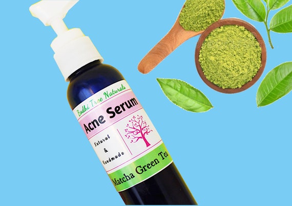 Acne Cleanser - Acne Treatment 2oz / Green Tea / Acne Serum / Problem skin / Oily skin / Homemade Natural Skin Care