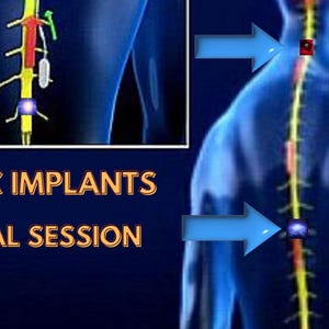 Etheric Implants Removal Session