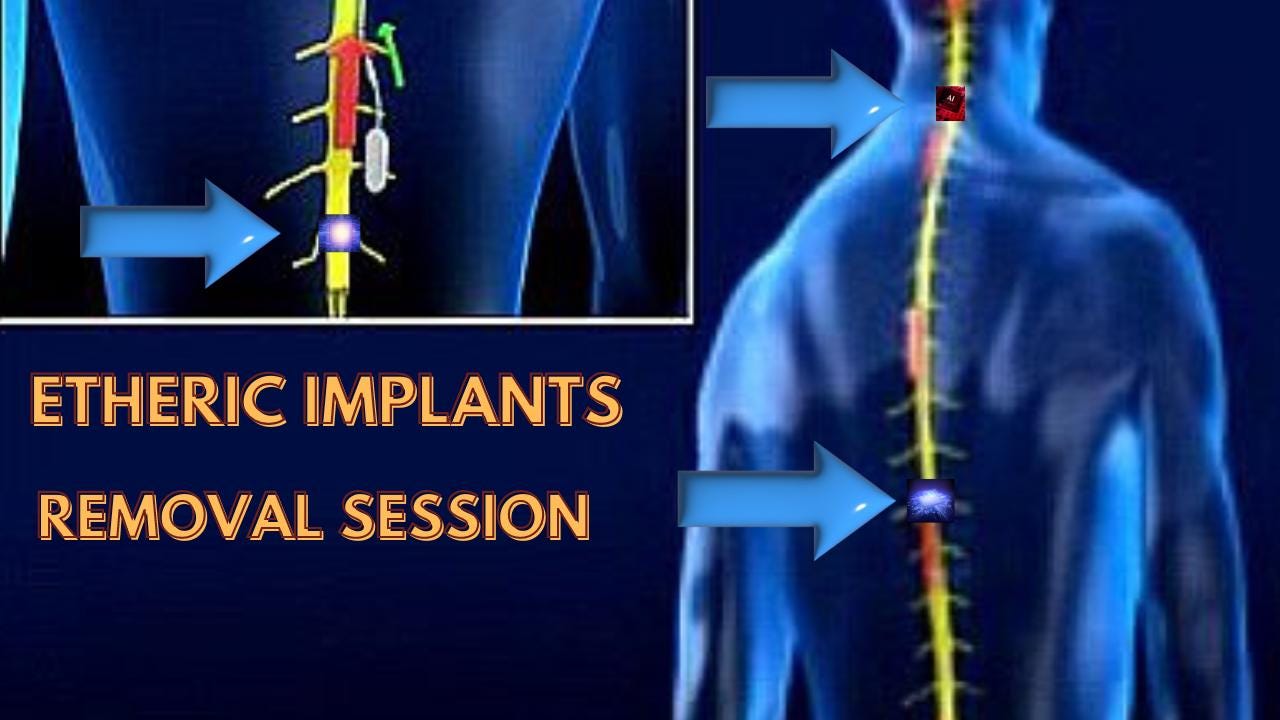 Etheric Implants Removal Session