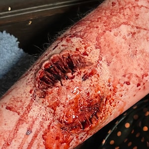 Może przedstawiać: Zbliżenie na krwawiącą ranę na ramieniu osoby. Rana jest głęboka i postrzępiona, wokół niej jest dużo krwi. Skóra jest rozdarta i widać dużo czerwonej krwi.