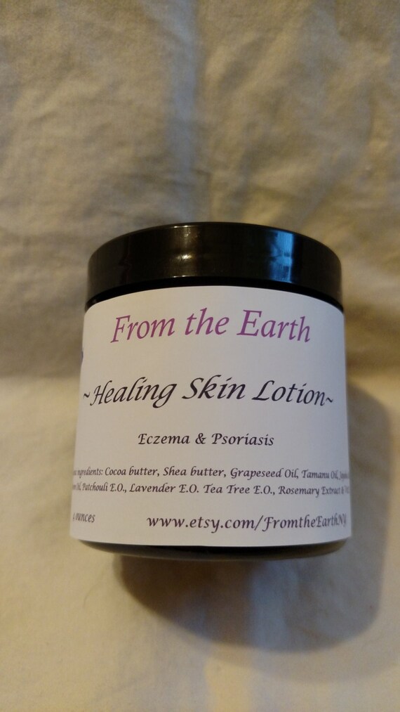 Healing Skin Lotion Organic Psoriasis EczemaHealing Dry Etsy