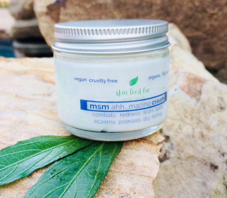 MSM Cream Acne Rosacea Psoriasis Eczema Skin Optimsm acne Etsy