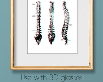 Op de afbeelding: Een ingelijste anatomische print met drie aanzichten van een menselijke wervelkolom met een rood en blauw 3D-anaglyfeffect. Het kunstwerk zit in een goudkleurige lijst. Onder de lijst staat de tekst: Use with 3D glasses! Fun wall art!