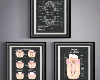Dental Anatomy Print Set, Meridian Tooth Chart Root Canal Wall Art, Dentist Hygienist Student Gift