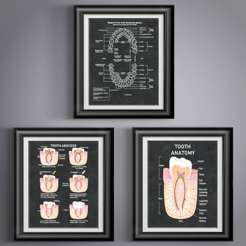 Dentist Gift Print Dental Office Decor Dental Dentist Art Etsy