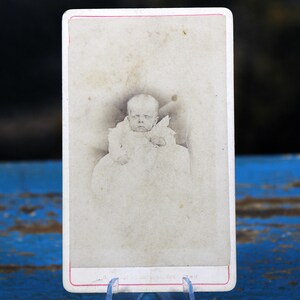 Post Mortem Baby Photo