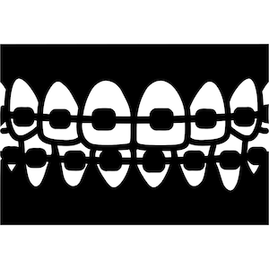 Aparaty ortodontyczne Svg, Zęby Svg, Dentysta Svg, Sylwetka clipartów dentystycznych, Plik cięcia wektorowego, Plik cięcia obrazu, Clip Art Zęby