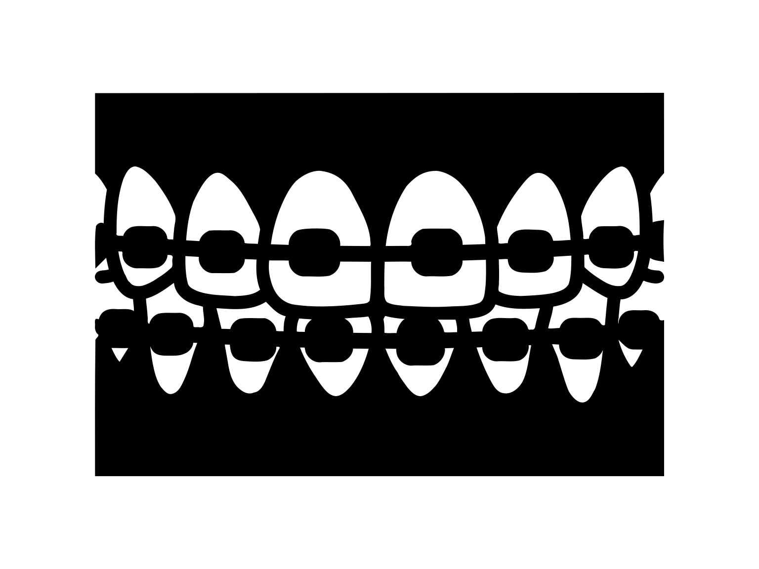 Braces Svg Tanden Svg Tandarts Svg Dental Clipart silhouet | Etsy