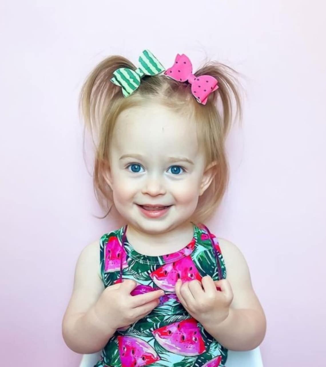 Watermelon Hair Clip Baby Hair Bow Baby Hair Clip Etsy