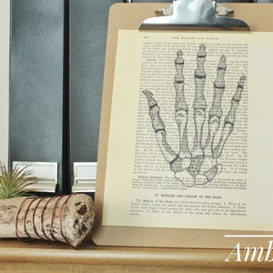 Anatomy, Hand Bones, Carpal Bones, Anatomy Art, Gray’s Anatomy Art