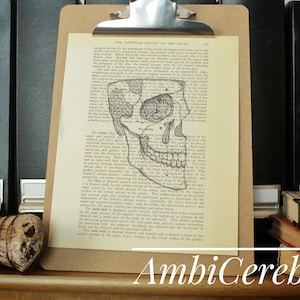 Anatomical Skull Art, anatomy art, grays anatomy, skull