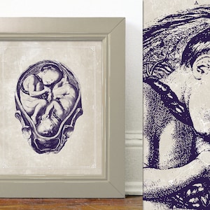 OBGYN Cartel Obstetricia Arte Gestación Anatomía Gemelos en Utero 8x10 11x14 16x20 18x24 24x36