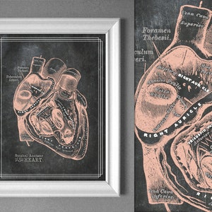 Surgical Heart Anatomy Art Print: Doctor Office Decor