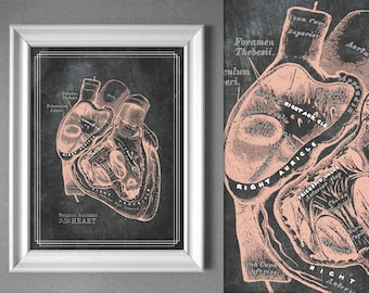 Lámina artística de anatomía cardíaca quirúrgica: Decoración para consultorios médicos