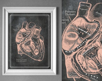 Surgical Heart Anatomy Cardiac Surgeon Doctor Art Medical Office Gym Cardiologist Study 8x10 11x14 16x20 18x24 24x36