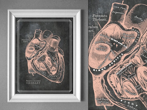 Surgical Heart Anatomy Cardiac Surgeon Doctor Art Medical | Etsy